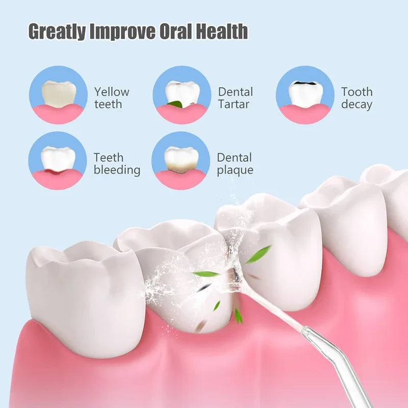 Water Oral Irrigator